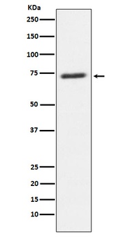 SENP1 Rabbit Monoclonal Antibody