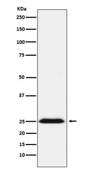 BAP31 Rabbit Monoclonal Antibody