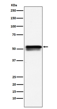 EGR2 Rabbit Monoclonal Antibody