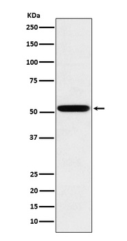 IgG2 Rabbit Monoclonal Antibody