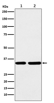 STUB1 Rabbit Monoclonal Antibody