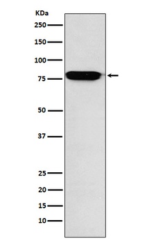 RANK Rabbit Monoclonal Antibody