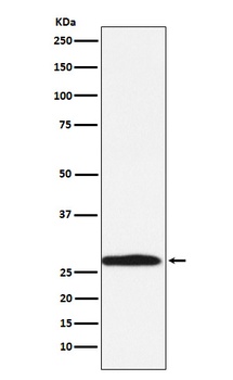Carbonic Anhydrase 1 Rabbit Monoclonal Antibody