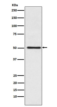 Cytochrome P450 17A1 Rabbit Monoclonal Antibody