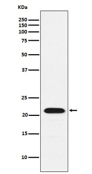 CBFb Rabbit Monoclonal Antibody