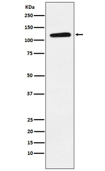 Eph receptor B1 Rabbit Monoclonal Antibody