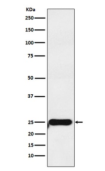 COMT Rabbit Monoclonal Antibody