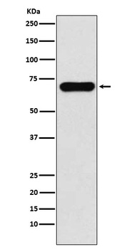 PCK1 Rabbit Monoclonal Antibody