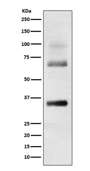 Loricrin Rabbit Monoclonal Antibody