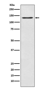 MGEA5 Rabbit Monoclonal Antibody
