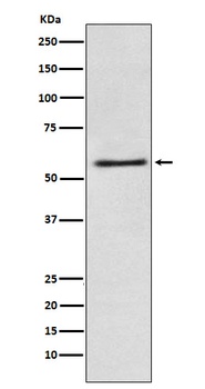 FAAH1 Rabbit Monoclonal Antibody