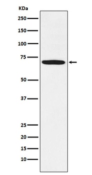 LIMK1 Rabbit Monoclonal Antibody