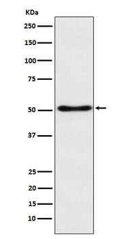 SFRP4 Rabbit Monoclonal Antibody