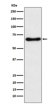 CYP24A1 Rabbit Monoclonal Antibody