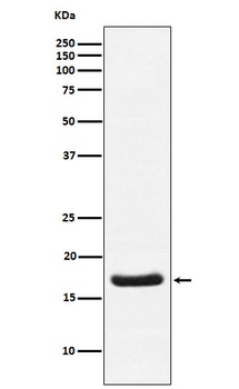 Cardiac Troponin C Rabbit Monoclonal Antibody