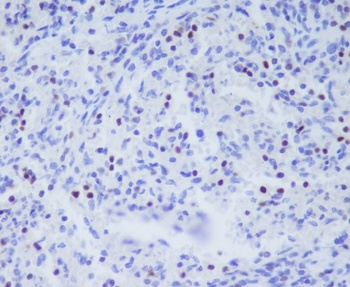 TBX21 Rabbit Monoclonal Antibody
