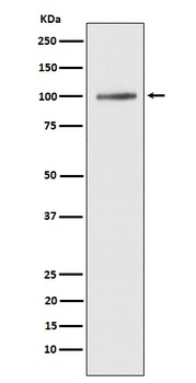 ATP2A1/SERCA1 Rabbit Monoclonal Antibody