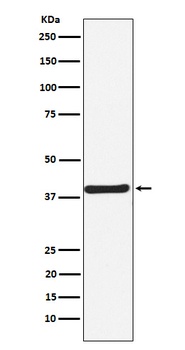 CaMKI Rabbit Monoclonal Antibody