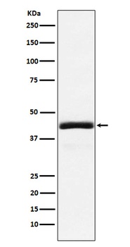 NEK2 Rabbit Monoclonal Antibody