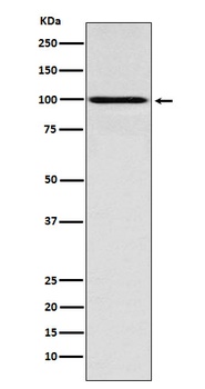 IFNGR1 Rabbit Monoclonal Antibody