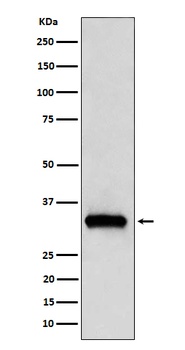 NDUFAF1 Rabbit Monoclonal Antibody