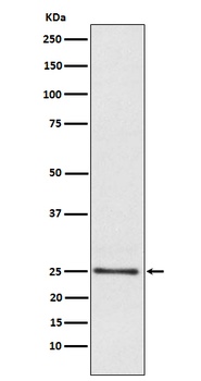Lysophospholipase 1 Rabbit Monoclonal Antibody