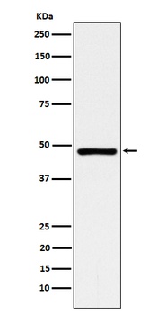 ACADM Rabbit Monoclonal Antibody
