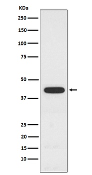 PCYT1A Rabbit Monoclonal Antibody