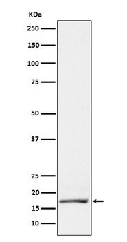 GCDFP 15 Rabbit Monoclonal Antibody