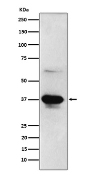 ICAD Rabbit Monoclonal Antibody