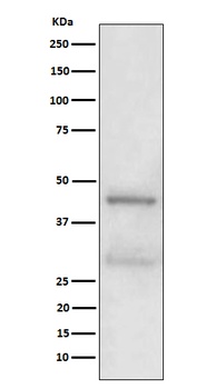 MBD2 Rabbit Monoclonal Antibody