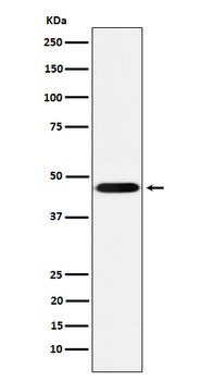 CD16 Rabbit Monoclonal Antibody