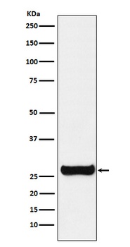 GSTM1 Rabbit Monoclonal Antibody