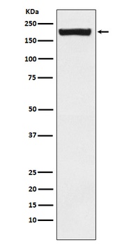 MRC2/ENDO180 Rabbit Monoclonal Antibody