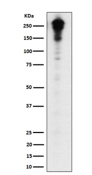 Desmoplakin Rabbit Monoclonal Antibody
