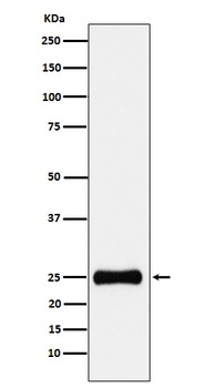 PSMA2 Rabbit Monoclonal Antibody