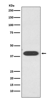 ZA2G/AZGP1 Rabbit Monoclonal Antibody