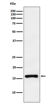 CDKN2C Rabbit Monoclonal Antibody