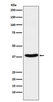 MT-ND1/MT Rabbit Monoclonal Antibody