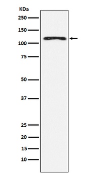 HLTF Rabbit Monoclonal Antibody
