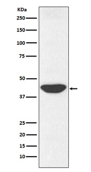 IDH1 Rabbit Monoclonal Antibody