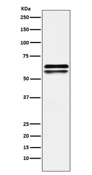 NAP1L1 Rabbit Monoclonal Antibody