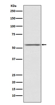 AMHR2 Rabbit Monoclonal Antibody