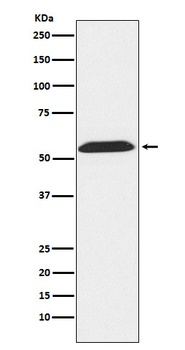 TXNRD2 Rabbit Monoclonal Antibody