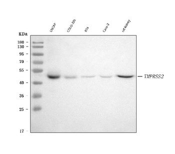 TMPRSS2 Rabbit Monoclonal Antibody