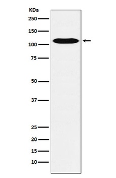 GPCR/LGR6 Rabbit Monoclonal Antibody