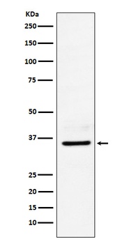 LDHB Rabbit Monoclonal Antibody