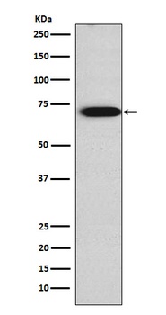 TRIM29 Rabbit Monoclonal Antibody