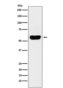 Salivary alpha amylase Rabbit Monoclonal Antibody