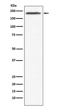 SMCHD1 Rabbit Monoclonal Antibody